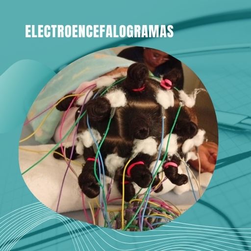 Electroencefalograma en Penonomé: Estudio de la Función Cerebral 15